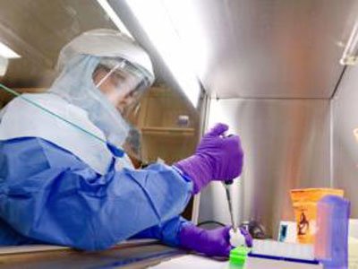 CDC呼吁所有孕妇进行兹卡病毒检测