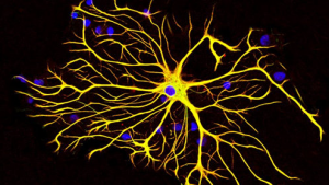 神经元也有“充电器” 星形胶质细胞有助脑损伤患者实现恢复