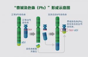 白血病靶向药迎来新进展：慢粒患者有望安全停药