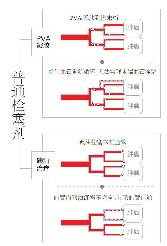 武汉成功研发纳米药能抑制肝癌转移，预计2018年上市