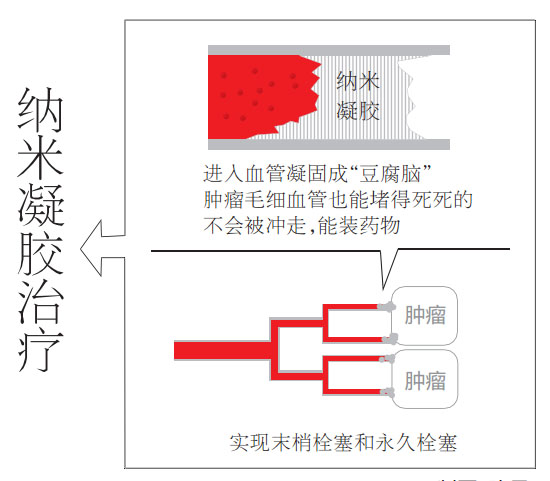 武汉成功研发纳米药能抑制肝癌转移，预计2018年上市