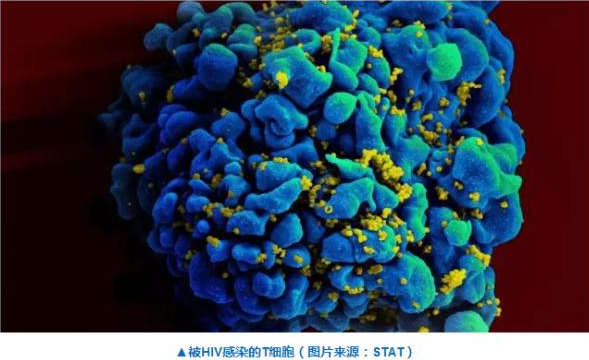 Cell子刊：CRISPR直击HIV感染的预防和治愈
