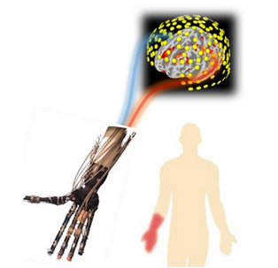 科学家成功利用大脑控制的机械假肢减轻幻肢痛