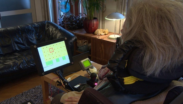 荷兰完成全球首例实用大脑植入手术，心灵感应有望成为现实