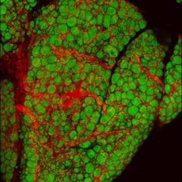Gene Dev:打开棕色化开关 让白色脂肪变棕色