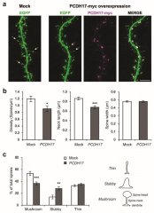 昆明动物所等揭示心境障碍易感机制