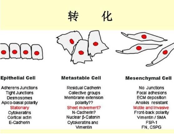 浙大科学家发现已获批糖尿病药物或可以治疗致命性乳腺癌