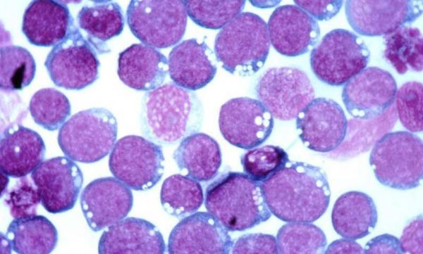 eLife：致癌病毒或可控制免疫细胞复制 促其永生