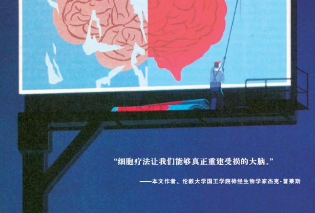 干细胞医学激动人心的进展:受损大脑有望修复!