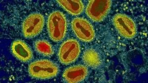 “世纪幽灵”天花病毒再度现身，或将被恐怖分子用作生物武器