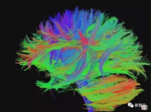 耶鲁神经科学扫描大脑判断人类智力，区分准确率达99%