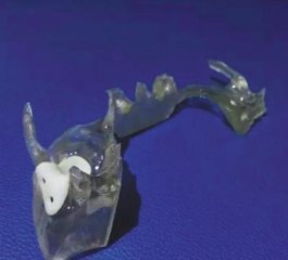 医生利用3D打印技术为患儿修复颅底缺损，行业标准仍待完善