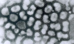 Sci Rep:不只健胃整肠!乳酸菌还能预防甲型流感病毒