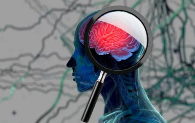 首次！Science揭示“第三杀手”帕金森相关蛋白损伤大脑细节