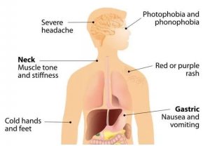 什么是脑膜炎球菌病？如何有效选择疫苗来抵御这种疾病呢？