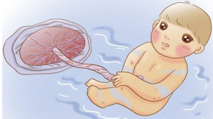 脐带间充质干细胞可免费留存