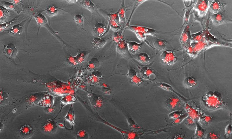 Science子刊：致命脑癌的“克星”？竟然是这个小分子