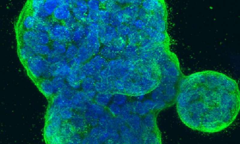 “有内鬼”！Nature子刊：有些乳腺癌会发“信号”阻止自身肿瘤扩散
