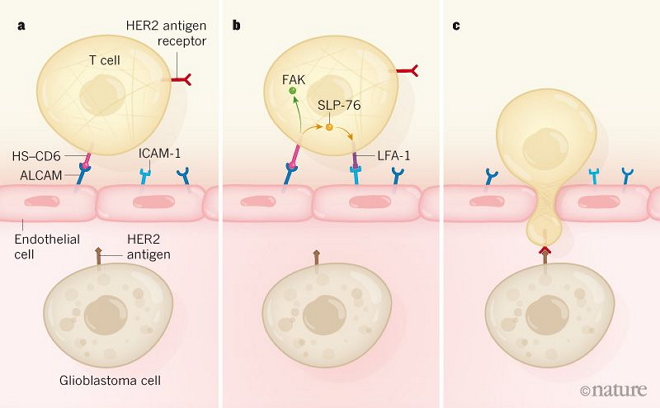脑瘤福音！Nature：“改造”T细胞，使其进入大脑、攻击“逃逸”的癌细胞