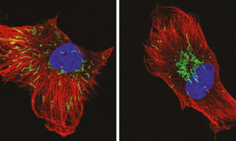 Nature子刊：阻断线粒体这一分子途径，可以降低乳腺癌侵袭性