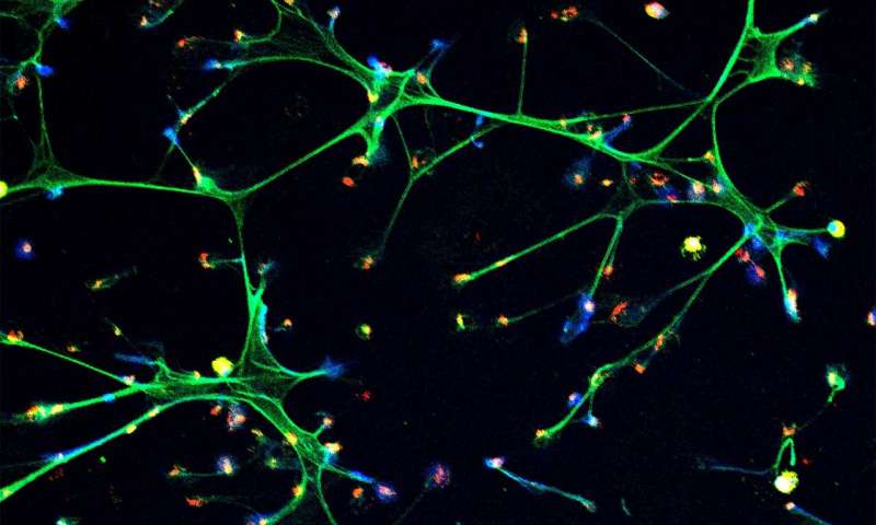 炎症诱导癌症复发？Science揭示：唤醒休眠癌细胞的信号