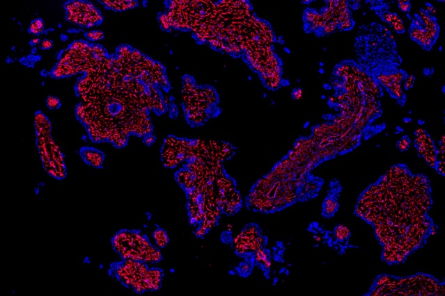 首张人类早期胎盘细胞图谱发表，可推进问题妊娠的研究| Science子刊