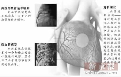 微血管病变男女后果有别：女性发病率高于男性