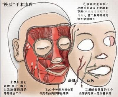 专家解密中国换脸方案：更换一只鼻子60万元